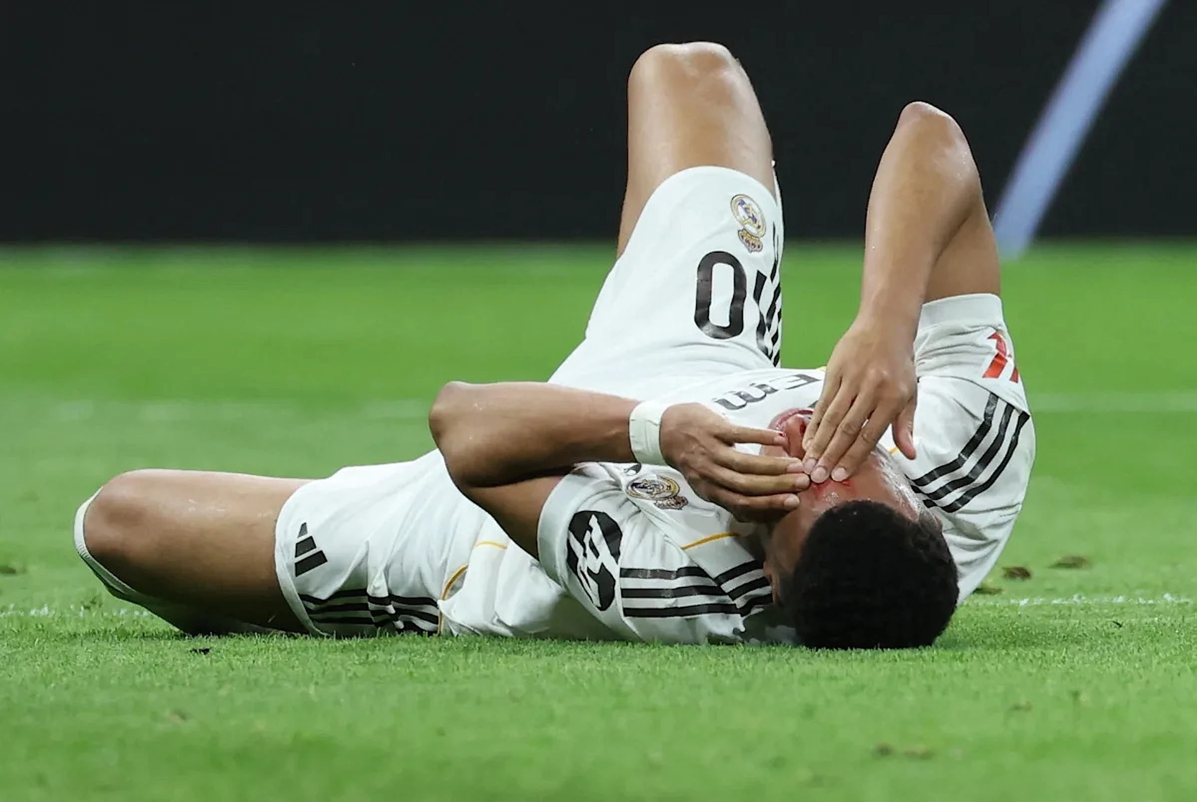 🤕 Mbappé, blood on his head! Arbeloa furious: Penalty, even on the moon 🤬