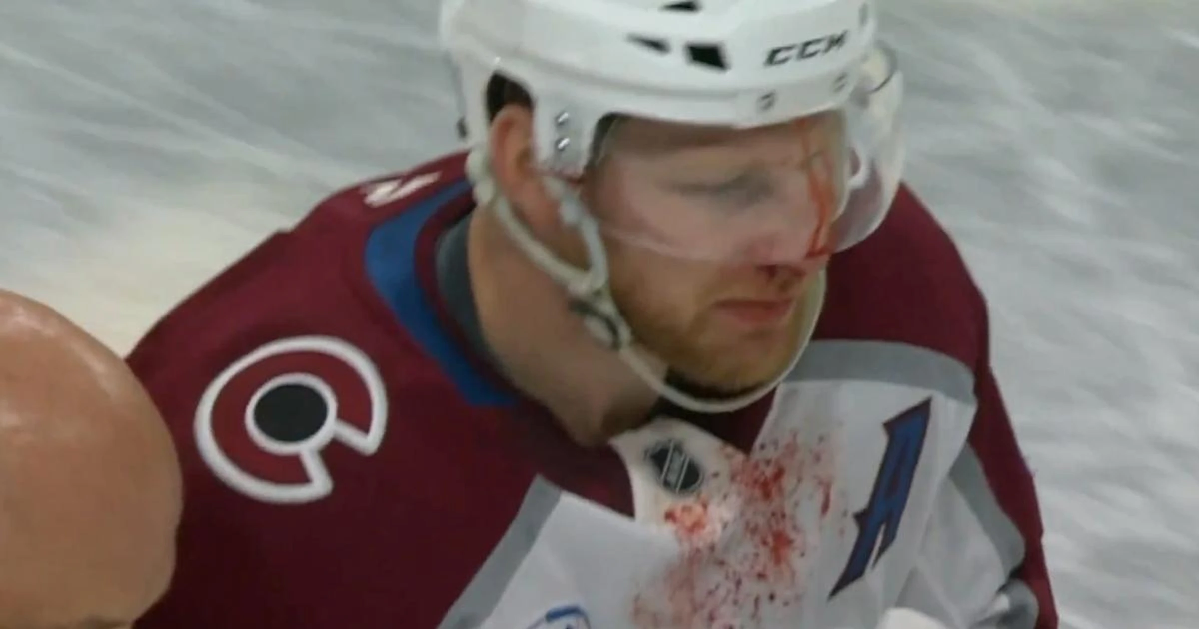 Nathan MacKinnon at the center of bloody scene in Game 4